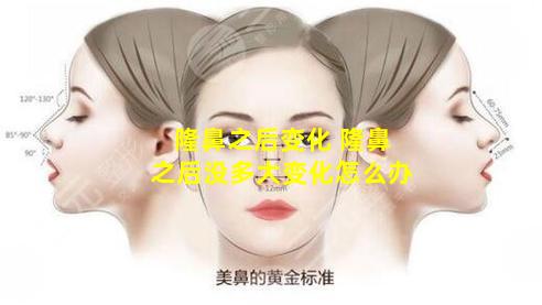 隆鼻之后变化 隆鼻之后没多大变化怎么办